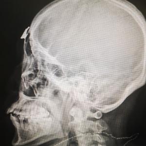 英明果断星球nk头像